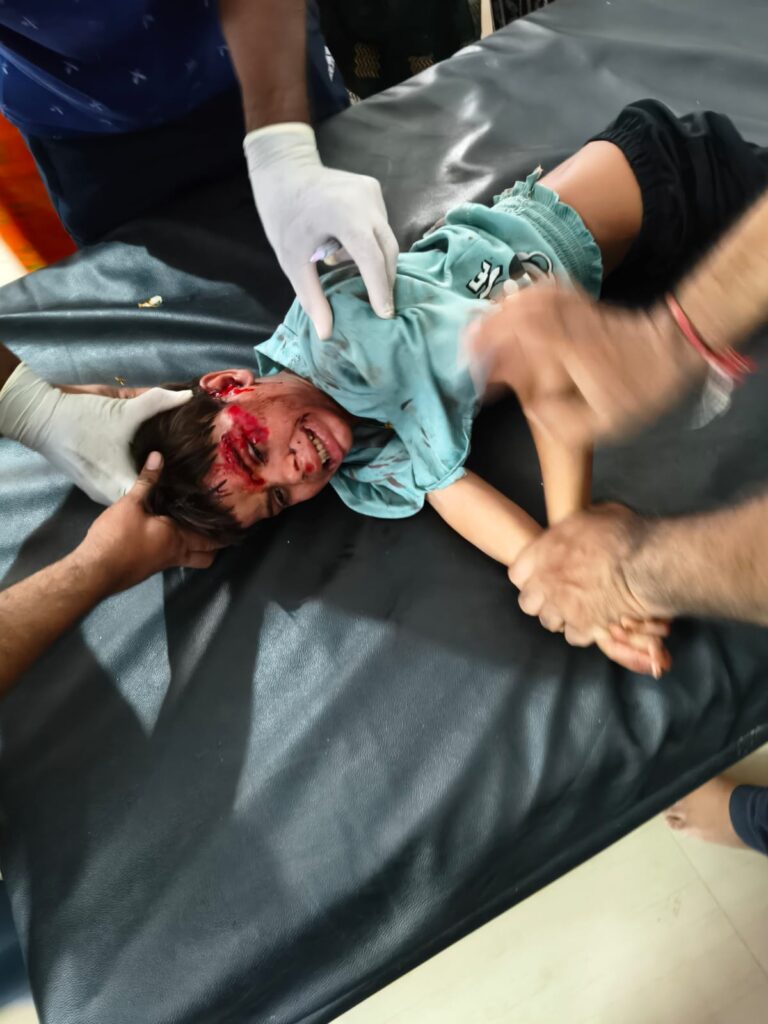 एमपी में बड़ा हादसा,ट्रैक्टर-ट्रॉली पलटने से 28 लोग घायल, बाइक सवार भी गंभीर